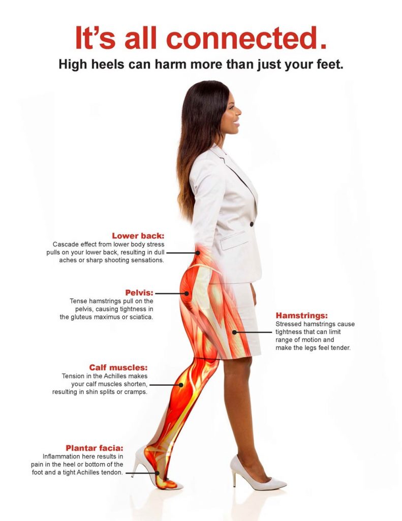 High heels harm more than just your feet